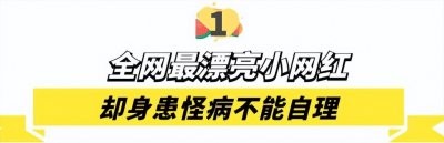 ​6岁“折翼天使”蓝妮妮：倾国倾城却身患怪病，将来可能成植物人