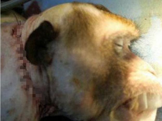 世界上首例成功的“换头手术”，耗时18小时花费7千万，现状如何