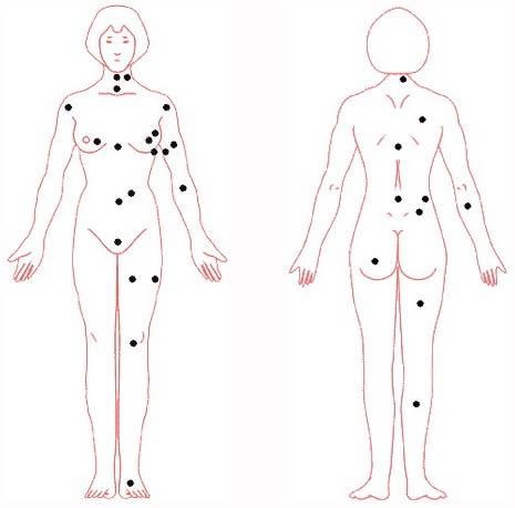 女痣身体图解大全 女人痣相图解全身