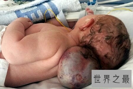 怪病有很多种 感觉这种病是最可怕的