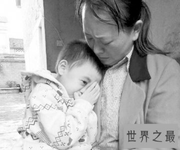 ​怪病有很多种 感觉这种病是最可怕的