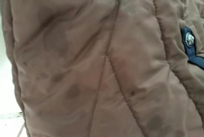 棉衣上的油渍怎么去除小窍门