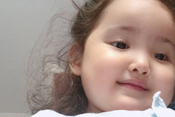 小刚几手指是什么病 巨指症妈妈说是被门夹了