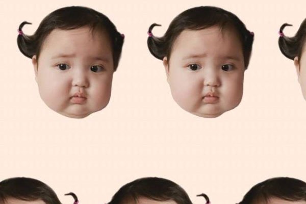 小刚几手指是什么病 巨指症妈妈说是被门夹了