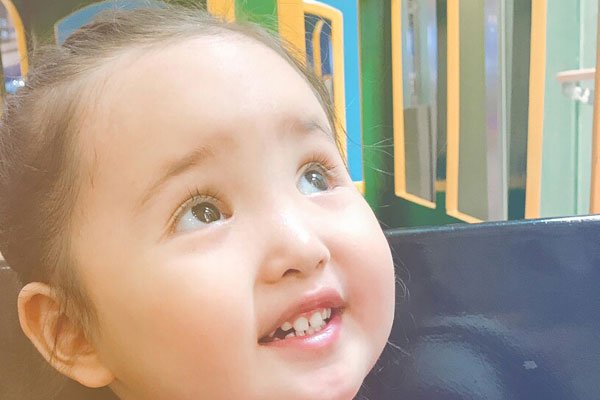 小刚几手指是什么病 巨指症妈妈说是被门夹了