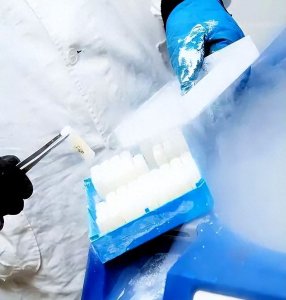 ​捐精狂魔乔纳森：和同伙混合精子捐献，害苦全球3000个不孕家庭