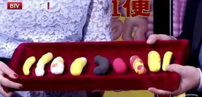 ​便便出现这4种颜色，可能是身体发出的“求救信号”，要重视