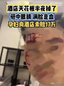 ​吵翻天！男子半夜被吊顶砸伤后索赔17万？家属发声，酒店：已送医