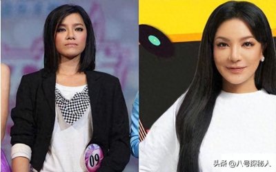 ​超女冠军江映蓉：过度医美后像＂怪物＂，全身只剩下眼珠是自己的